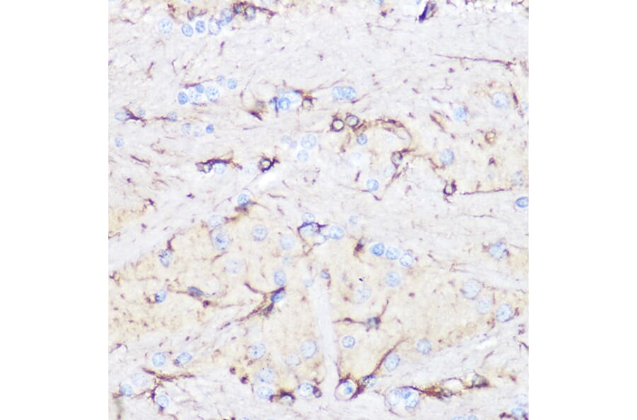 Immunohistochemistry - Anti-GFAP Antibody (A12563) - Antibodies.com