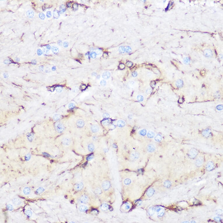 Immunohistochemistry - Anti-GFAP Antibody (A12563) - Antibodies.com