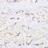 Immunohistochemistry - Anti-GFAP Antibody (A12563) - Antibodies.com