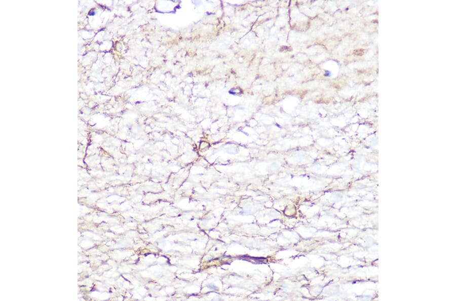 Immunohistochemistry - Anti-GFAP Antibody (A12563) - Antibodies.com