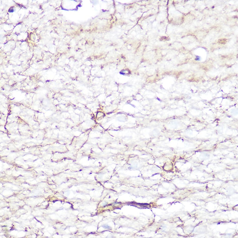 Immunohistochemistry - Anti-GFAP Antibody (A12563) - Antibodies.com