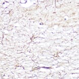 Immunohistochemistry - Anti-GFAP Antibody (A12563) - Antibodies.com