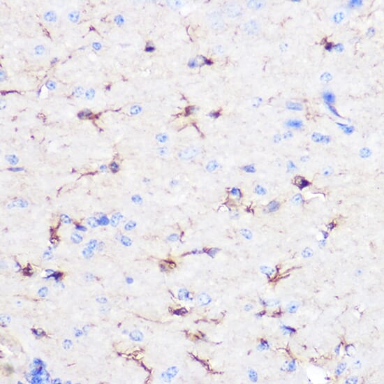 Anti-GFAP Antibody (A12563) | Antibodies.com