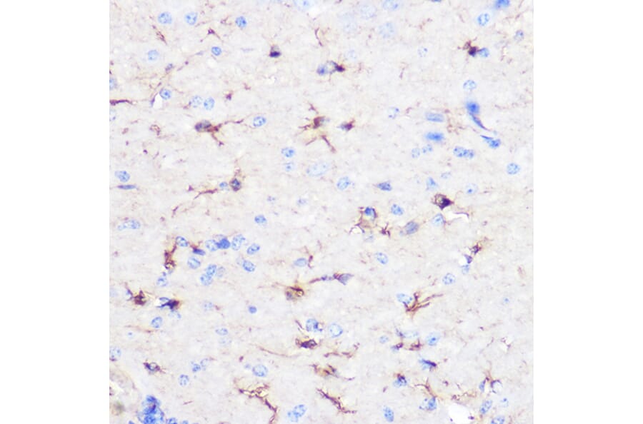 Immunohistochemistry - Anti-GFAP Antibody (A12563) - Antibodies.com