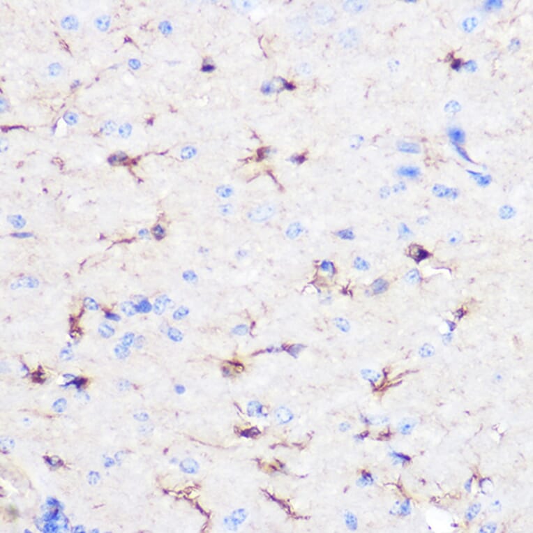Immunohistochemistry - Anti-GFAP Antibody (A12563) - Antibodies.com