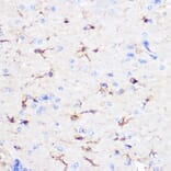 Immunohistochemistry - Anti-GFAP Antibody (A12563) - Antibodies.com