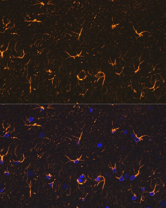 Anti-GFAP Antibody (A12563) | Antibodies.com