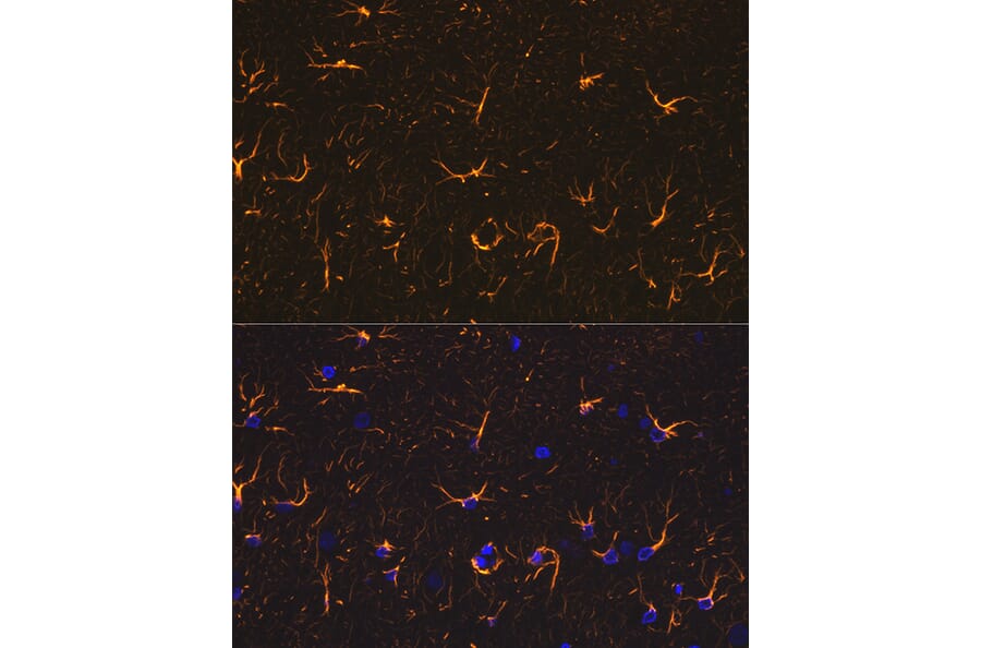 Immunofluorescence - Anti-GFAP Antibody (A12563) - Antibodies.com