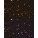Immunofluorescence - Anti-GFAP Antibody (A12563) - Antibodies.com