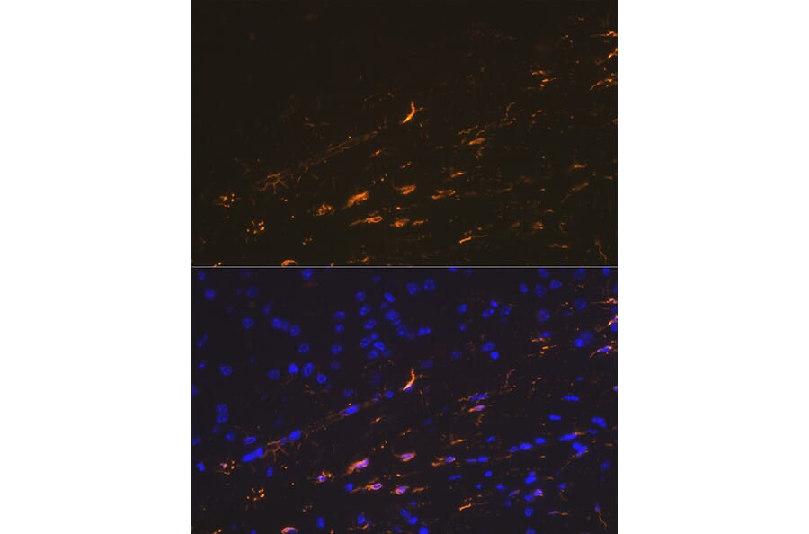 Immunofluorescence - Anti-GFAP Antibody (A12563) - Antibodies.com