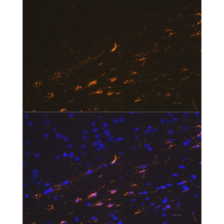 Immunofluorescence - Anti-GFAP Antibody (A12563) - Antibodies.com