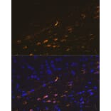 Immunofluorescence - Anti-GFAP Antibody (A12563) - Antibodies.com