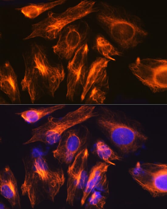 Anti-GFAP Antibody (A12563) | Antibodies.com