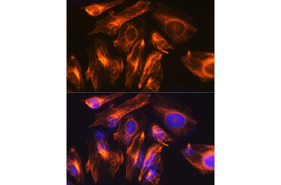 Immunofluorescence - Anti-GFAP Antibody (A12563) - Antibodies.com