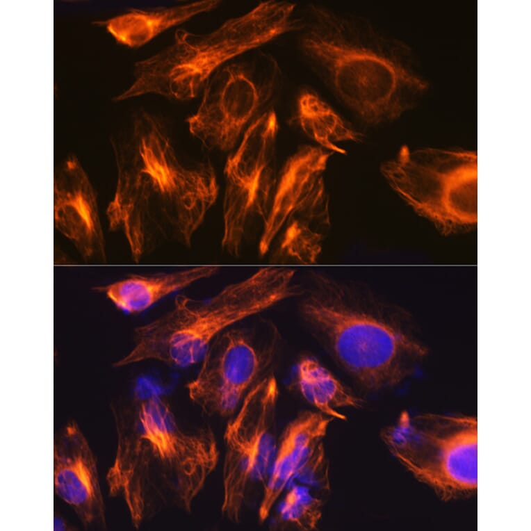 Immunofluorescence - Anti-GFAP Antibody (A12563) - Antibodies.com