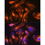 Immunofluorescence - Anti-GFAP Antibody (A12563) - Antibodies.com