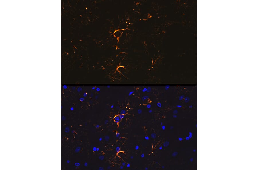 Immunofluorescence - Anti-GFAP Antibody (A12563) - Antibodies.com