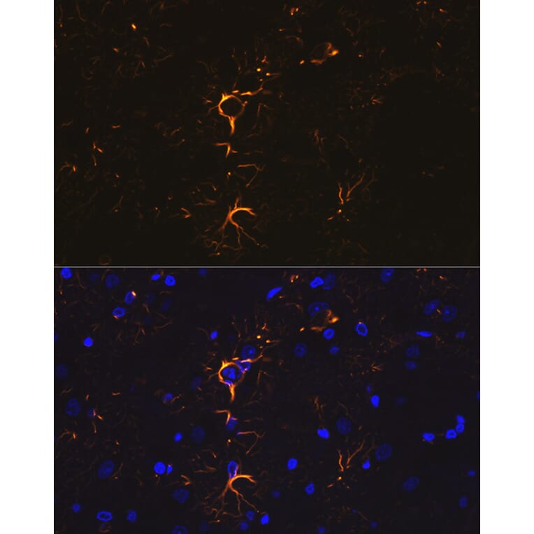 Immunofluorescence - Anti-GFAP Antibody (A12563) - Antibodies.com