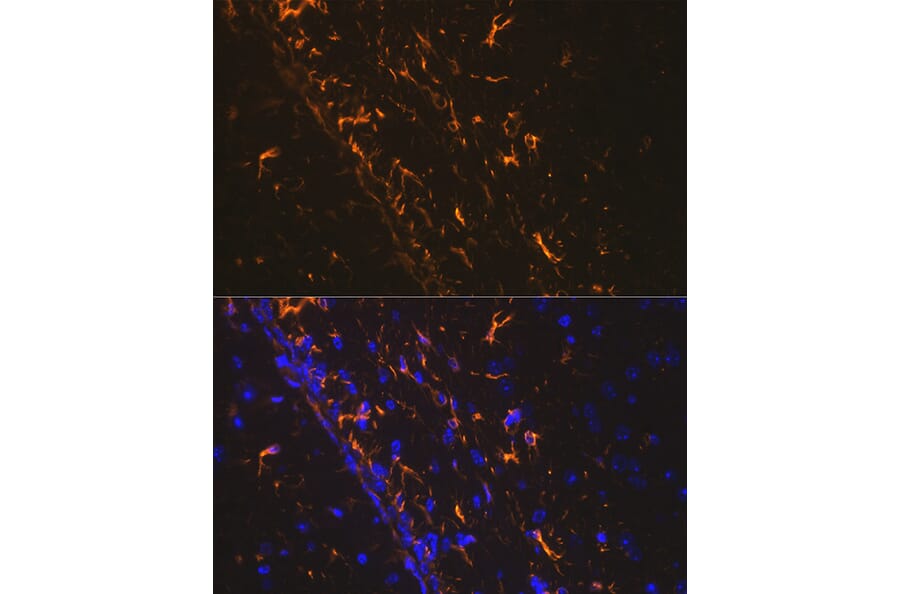 Immunofluorescence - Anti-GFAP Antibody (A12563) - Antibodies.com