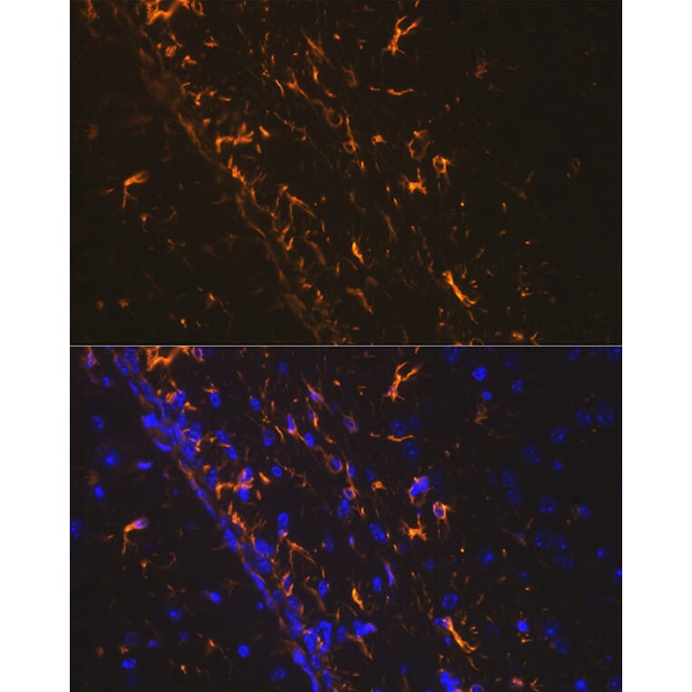 Immunofluorescence - Anti-GFAP Antibody (A12563) - Antibodies.com
