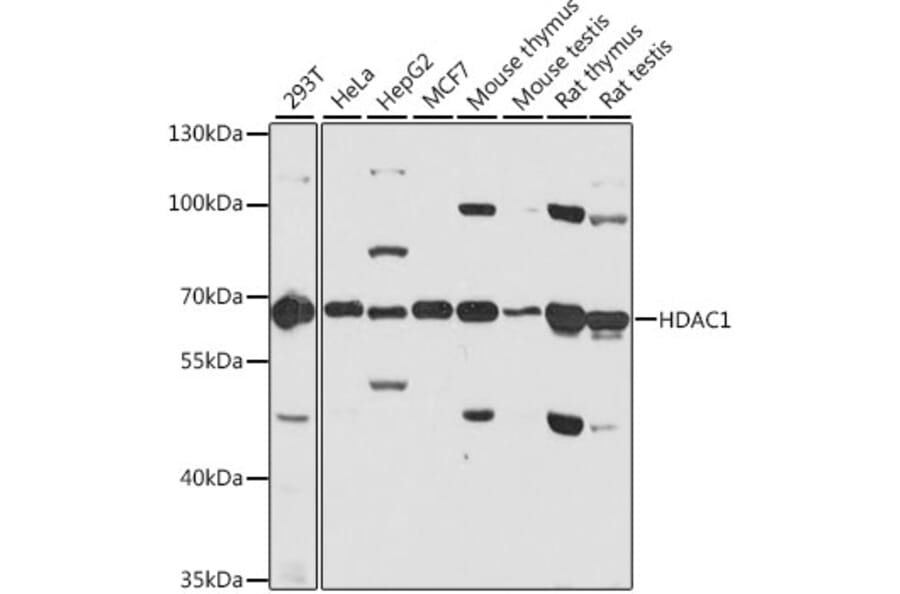 Western Blot - Anti-HDAC1 Antibody (A12564) - Antibodies.com