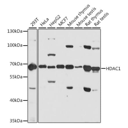 Western Blot - Anti-HDAC1 Antibody (A12564) - Antibodies.com