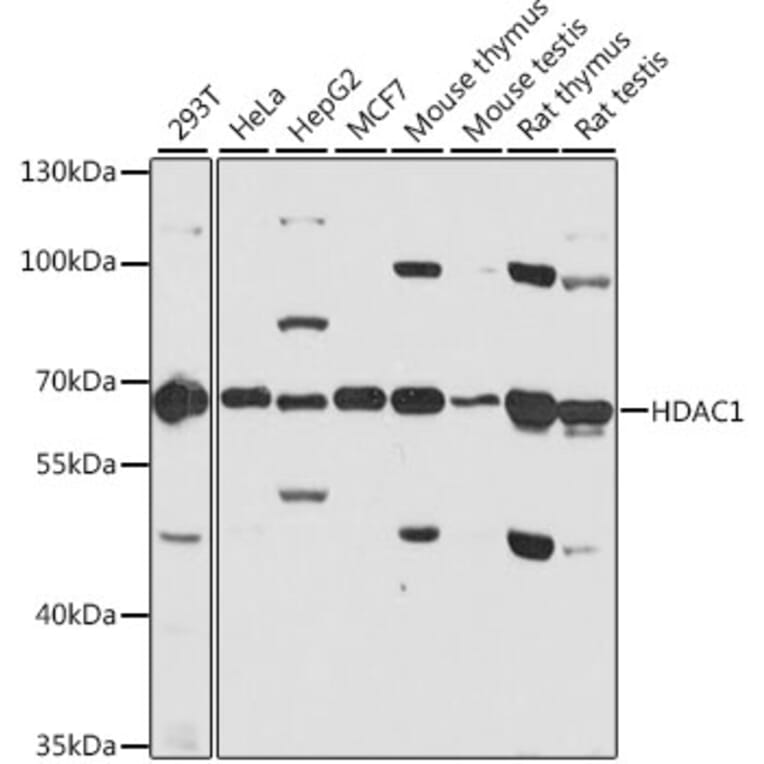 Western Blot - Anti-HDAC1 Antibody (A12564) - Antibodies.com