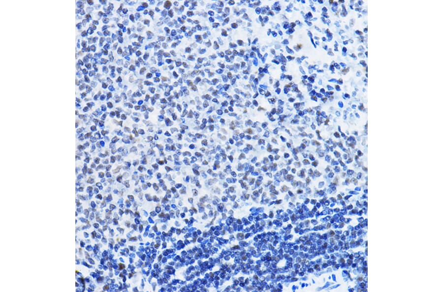 Immunohistochemistry - Anti-HDAC1 Antibody (A12564) - Antibodies.com