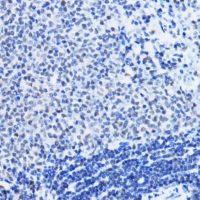 Immunohistochemistry - Anti-HDAC1 Antibody (A12564) - Antibodies.com