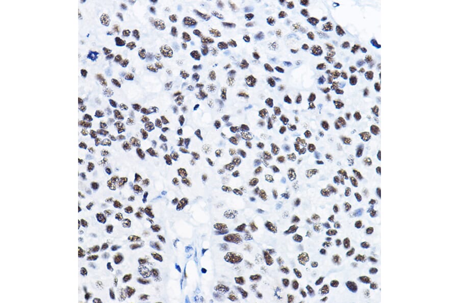 Immunohistochemistry - Anti-HDAC1 Antibody (A12564) - Antibodies.com