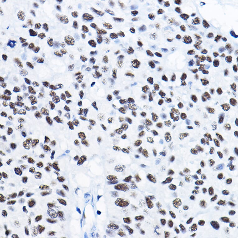 Immunohistochemistry - Anti-HDAC1 Antibody (A12564) - Antibodies.com