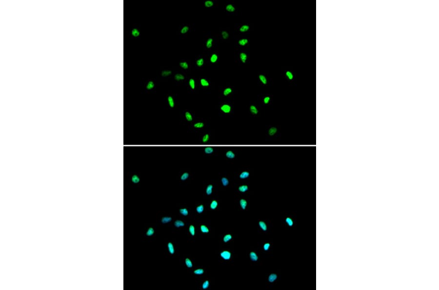 Immunofluorescence - Anti-HDAC1 Antibody (A12564) - Antibodies.com