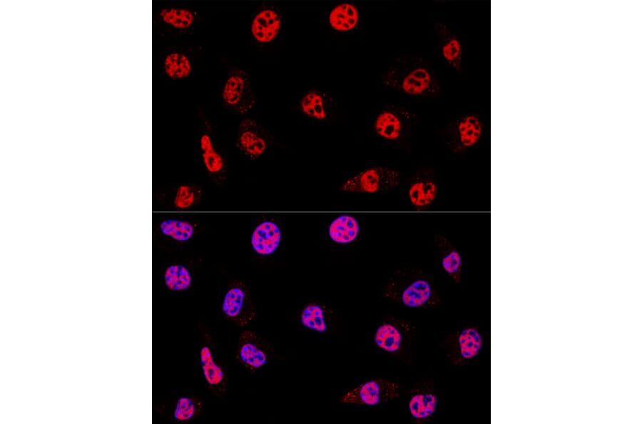 Immunofluorescence - Anti-HDAC1 Antibody (A12564) - Antibodies.com