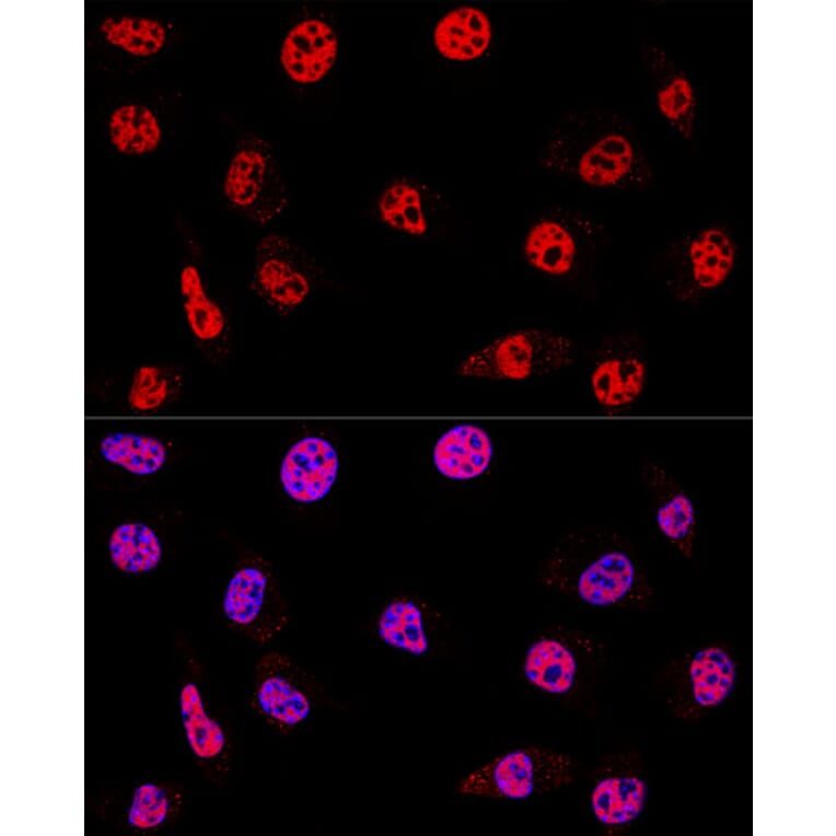 Immunofluorescence - Anti-HDAC1 Antibody (A12564) - Antibodies.com