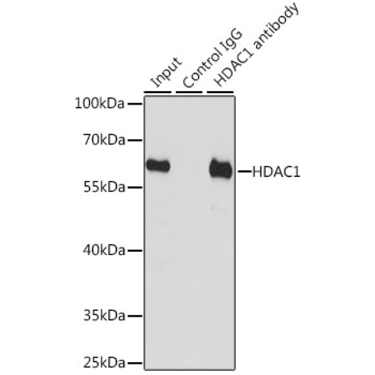 Anti-HDAC1 Antibody (A12564) | Antibodies.com