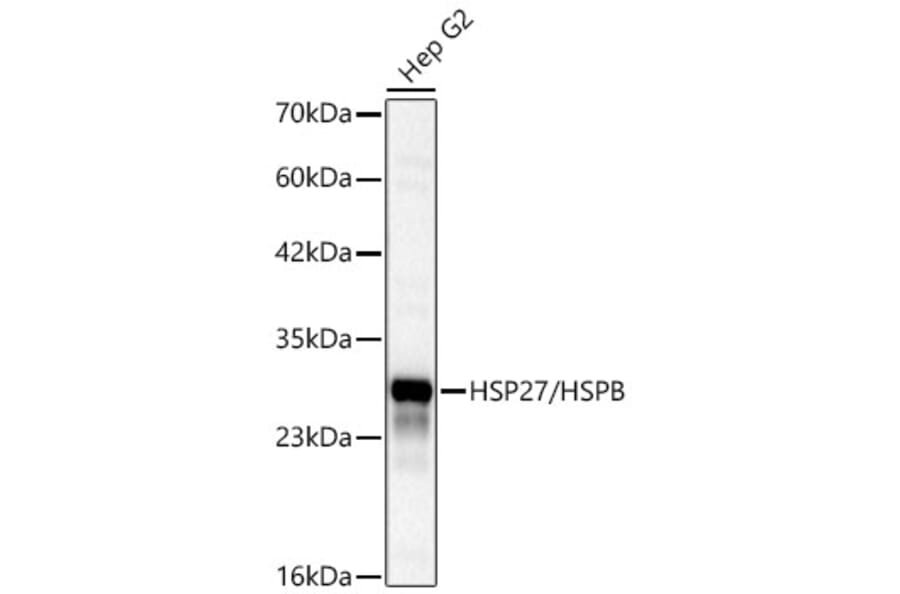 Western Blot - Anti-HSP27 Antibody (A12566) - Antibodies.com