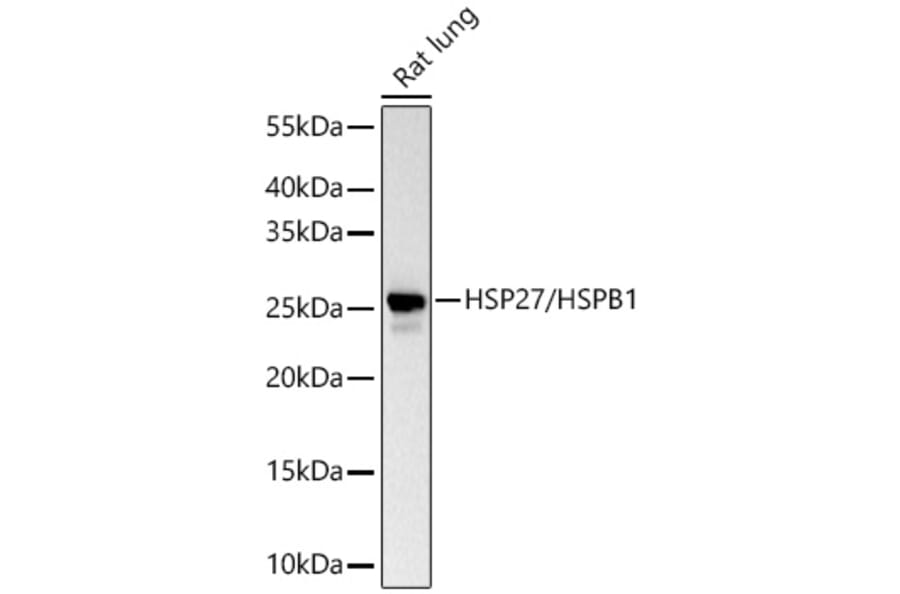 Western Blot - Anti-HSP27 Antibody (A12566) - Antibodies.com