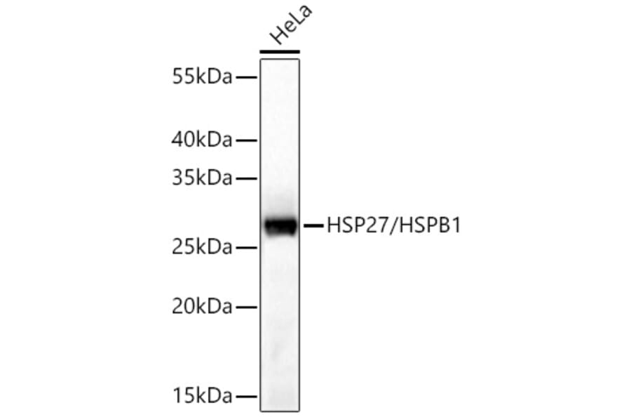 Western Blot - Anti-HSP27 Antibody (A12566) - Antibodies.com