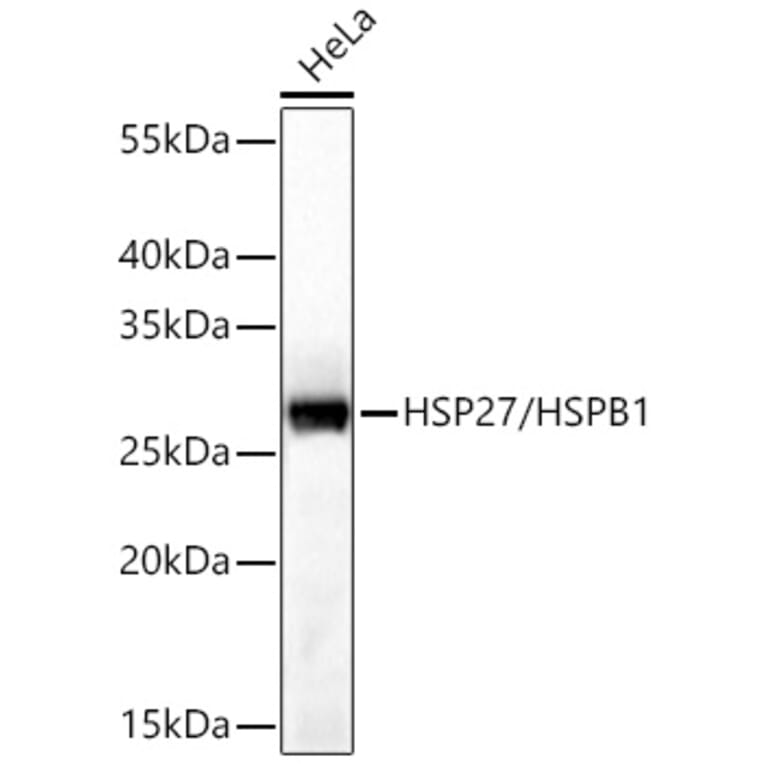 Western Blot - Anti-HSP27 Antibody (A12566) - Antibodies.com