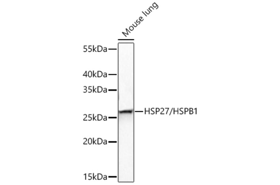 Western Blot - Anti-HSP27 Antibody (A12566) - Antibodies.com