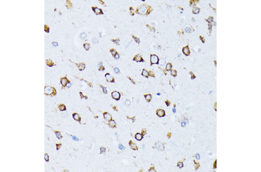 Immunohistochemistry - Anti-GRP78 BiP Antibody (A12567) - Antibodies.com