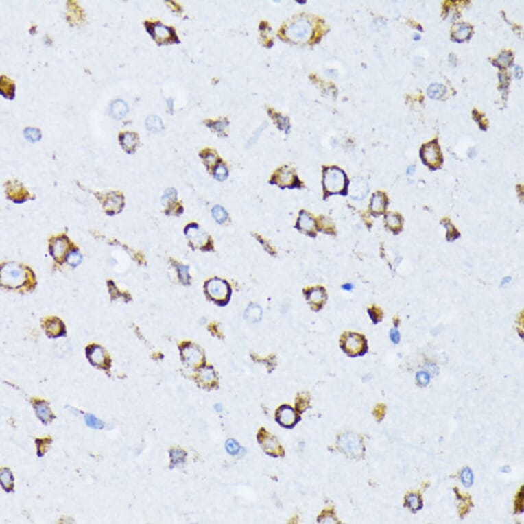 Immunohistochemistry - Anti-GRP78 BiP Antibody (A12567) - Antibodies.com