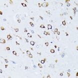 Immunohistochemistry - Anti-GRP78 BiP Antibody (A12567) - Antibodies.com