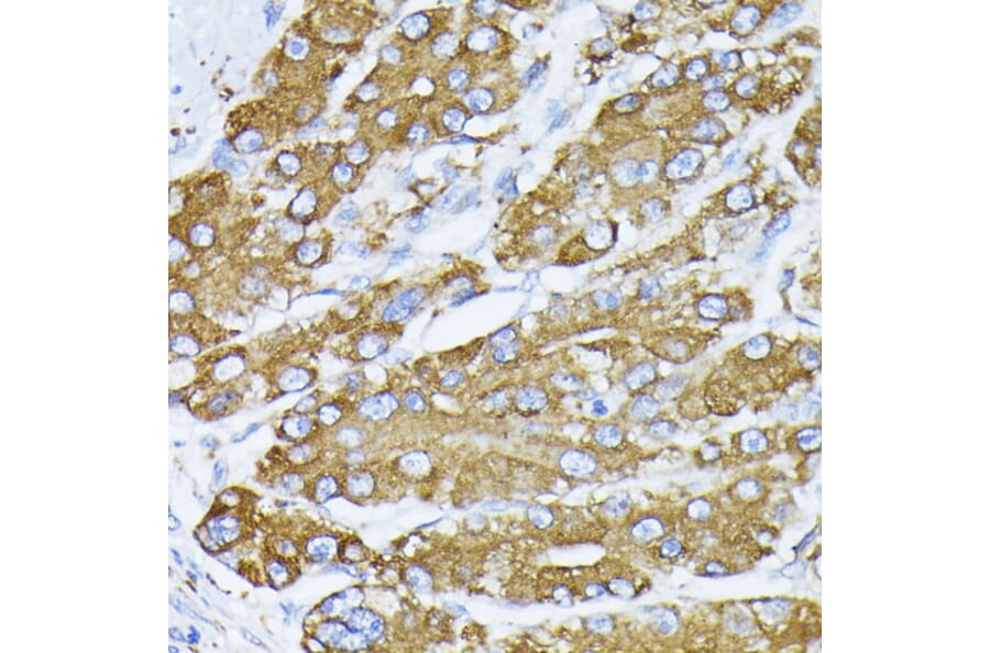 Immunohistochemistry - Anti-GRP78 BiP Antibody (A12567) - Antibodies.com