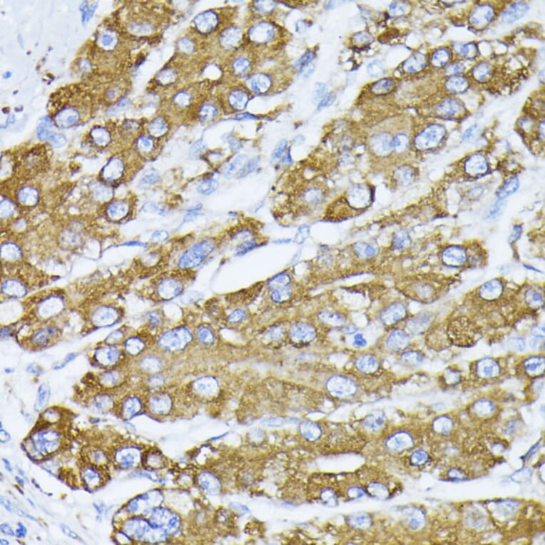 Immunohistochemistry - Anti-GRP78 BiP Antibody (A12567) - Antibodies.com