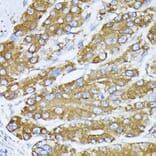 Immunohistochemistry - Anti-GRP78 BiP Antibody (A12567) - Antibodies.com