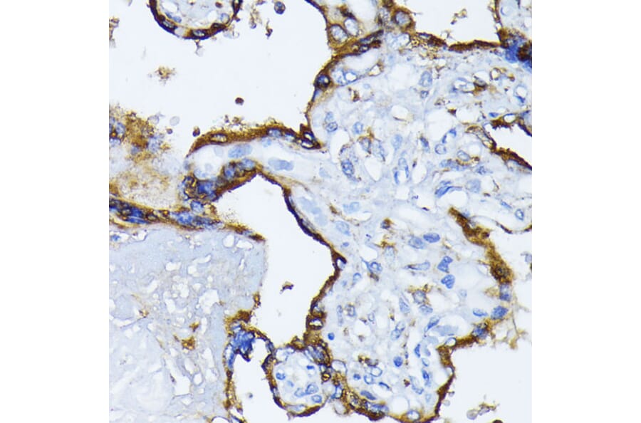 Immunohistochemistry - Anti-GRP78 BiP Antibody (A12567) - Antibodies.com