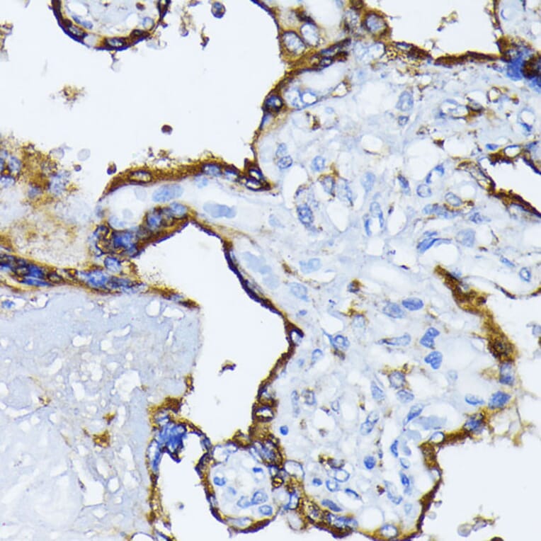 Immunohistochemistry - Anti-GRP78 BiP Antibody (A12567) - Antibodies.com