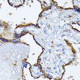 Immunohistochemistry - Anti-GRP78 BiP Antibody (A12567) - Antibodies.com