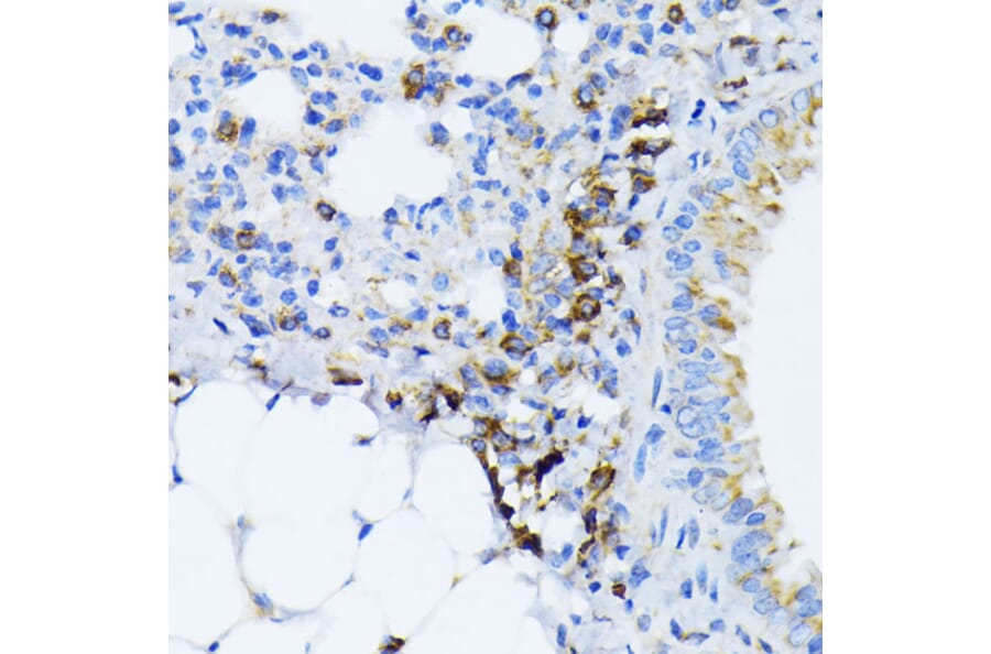Immunohistochemistry - Anti-GRP78 BiP Antibody (A12567) - Antibodies.com